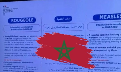 وسط تكتم مغربي ..فرنسا تحذر رعاياها من تفشي وباء الحصبة في المغرب ..